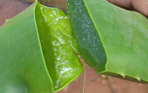 gel di Aloe vera