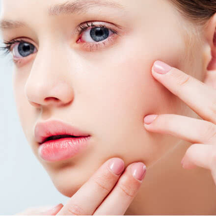 Trattamenti per pelli acneiche e grasse